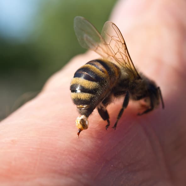 Stachel nach Bienenstich richtig entfernen