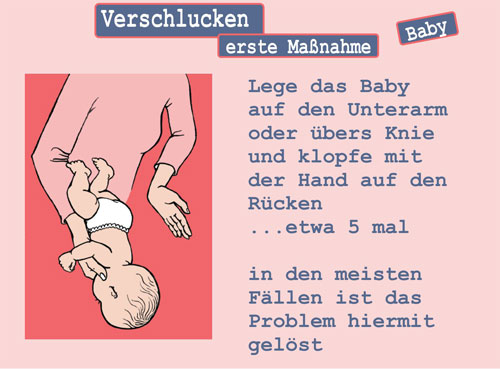 Verschlucken bei Babys - erste Maßnahme